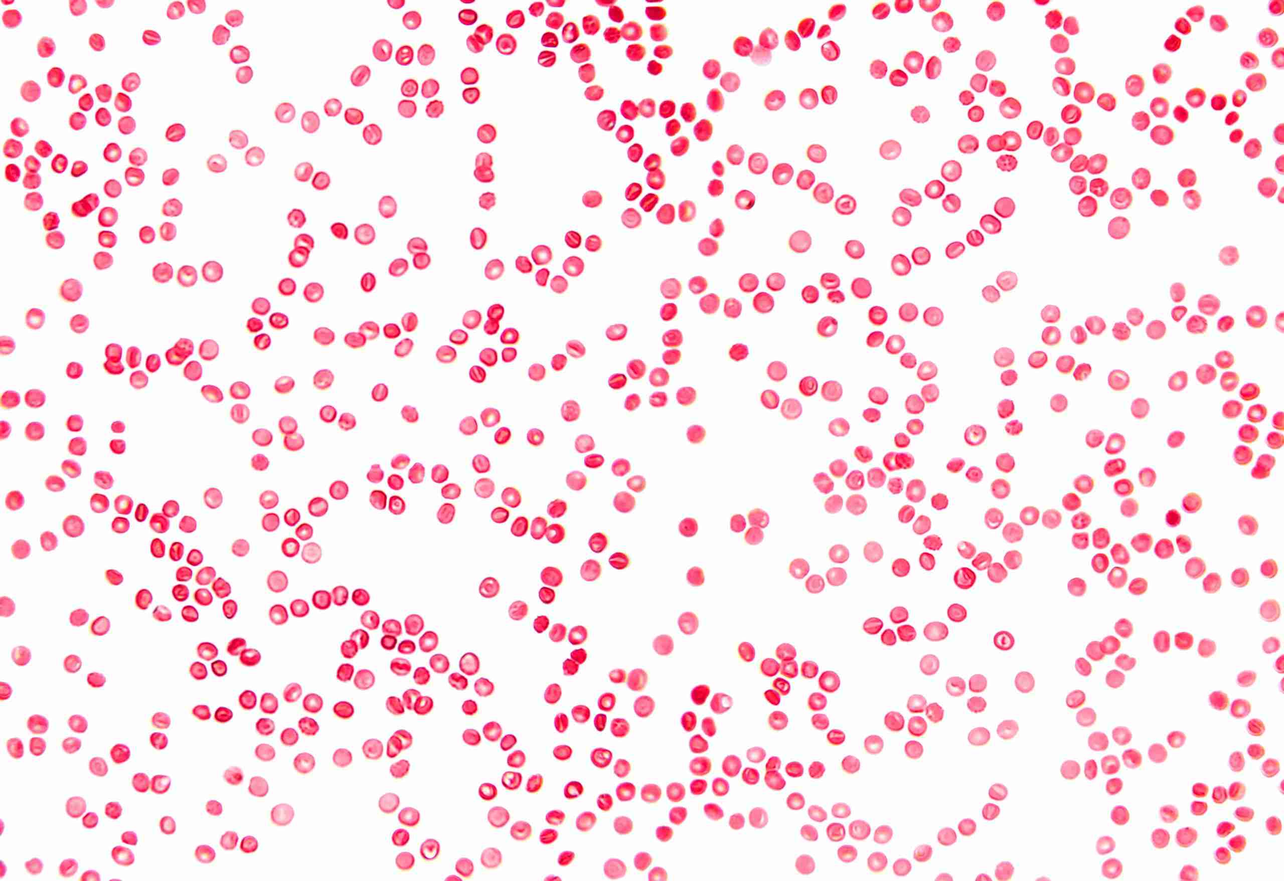 Module Hematologische Spoed – Leertraject Spoed en Intensieve Zorgen Jan 2026